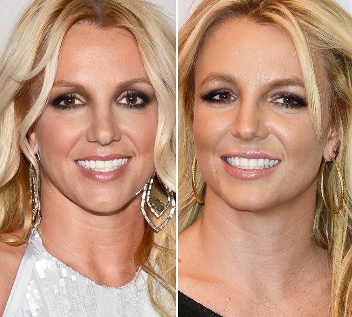 BRITNEY SPEARS: Before and After Plastic Surgey - YouTube
