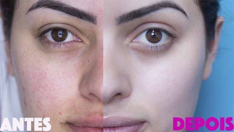 Antes e depois da Kim Cuca Rosa